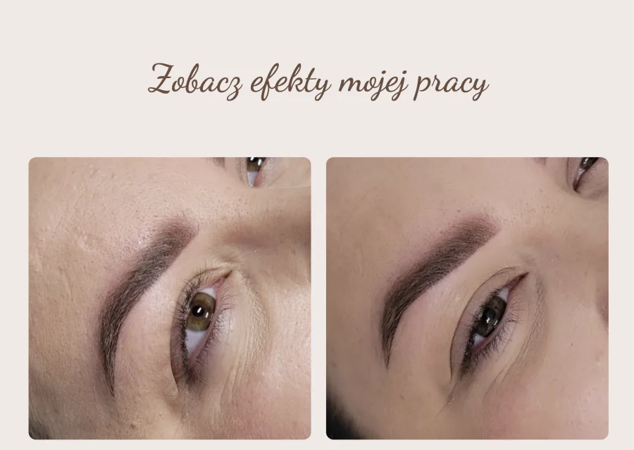 Zwierciadło Urody — treatment results, before and after
